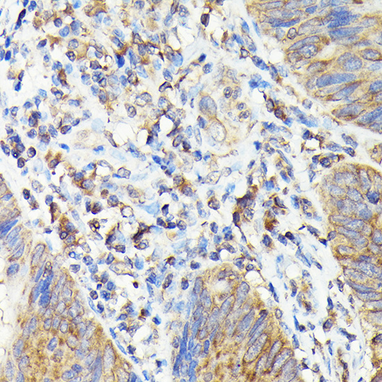 TAP2 Rabbit polyclonal antibody