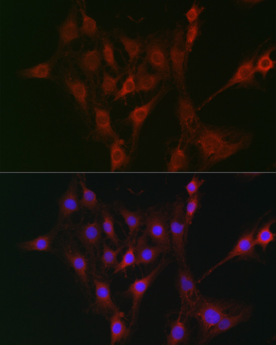 TAP2 Rabbit polyclonal antibody