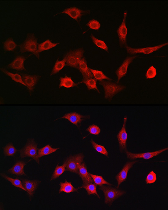 TAP2 Rabbit polyclonal antibody