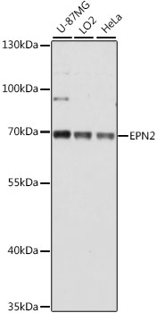 EPN2 Rabbit polyclonal antibody