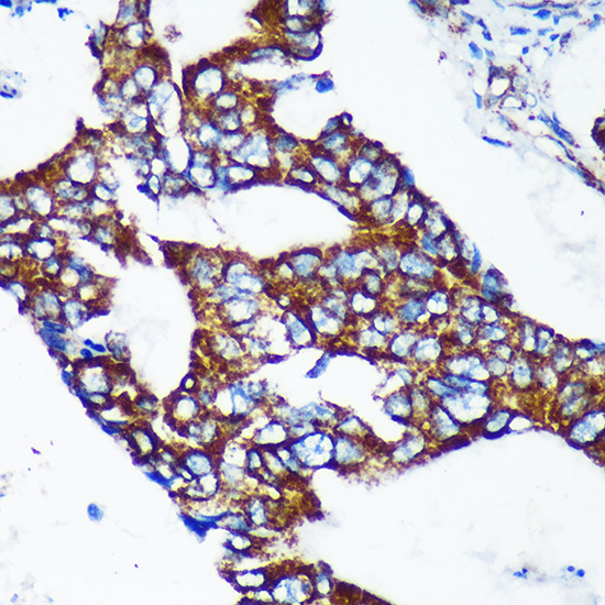 EPN2 Rabbit polyclonal antibody