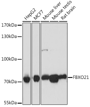 FBXO21 Rabbit polyclonal antibody