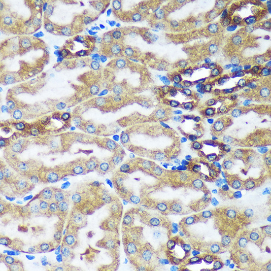 FBXO21 Rabbit polyclonal antibody