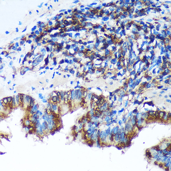 FBXO21 Rabbit polyclonal antibody