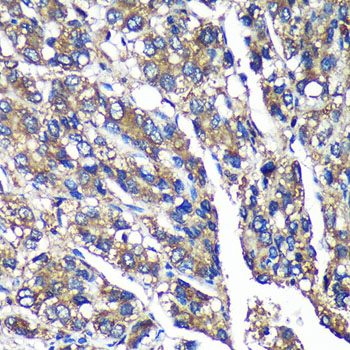 FBXO21 Rabbit polyclonal antibody