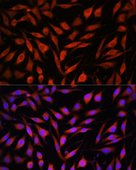 FBXO21 Rabbit polyclonal antibody