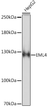 EML4 Rabbit polyclonal antibody