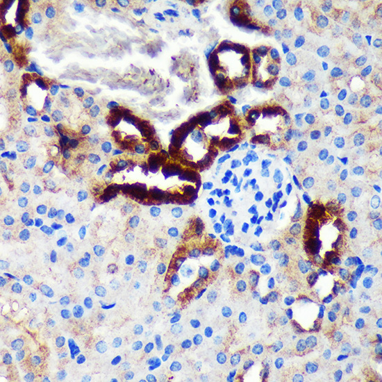 EML4 Rabbit polyclonal antibody