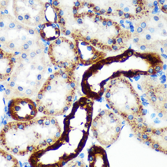 EML4 Rabbit polyclonal antibody