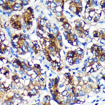 EML4 Rabbit polyclonal antibody