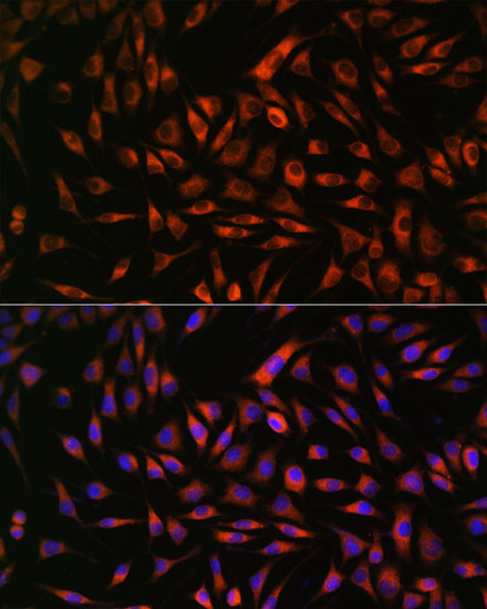 EML4 Rabbit polyclonal antibody