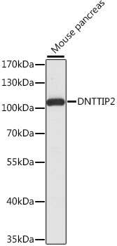 DNTTIP2 Rabbit polyclonal antibody