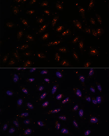 DNTTIP2 Rabbit polyclonal antibody