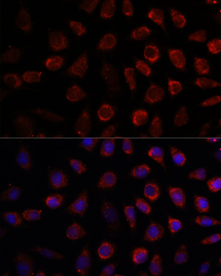 PDE11A Rabbit polyclonal antibody