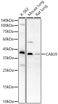 CAB39 Rabbit polyclonal antibody