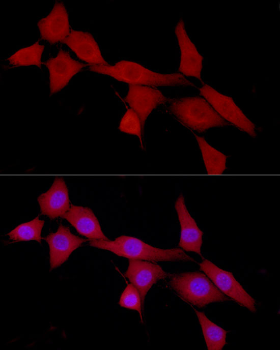 CAB39 Rabbit polyclonal antibody