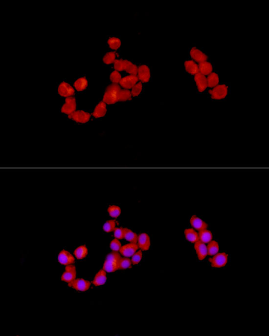 CAB39 Rabbit polyclonal antibody