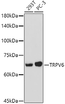 TRPV6 Rabbit polyclonal antibody