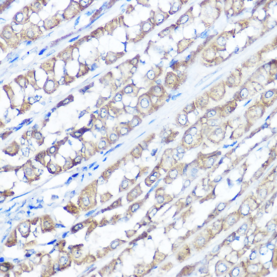 TRPV6 Rabbit polyclonal antibody
