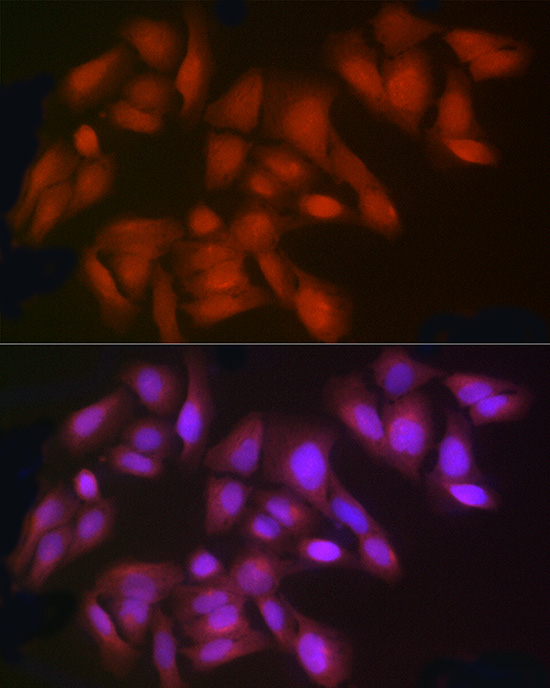 IDO1 Rabbit polyclonal antibody