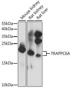 TRAPPC6A Rabbit polyclonal antibody