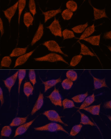 TRAPPC6A Rabbit polyclonal antibody