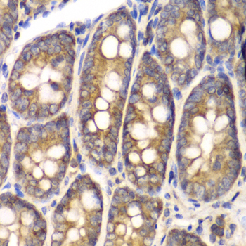 SPARC Rabbit polyclonal antibody