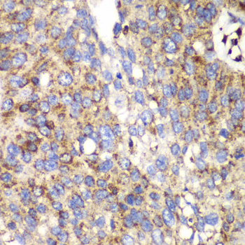 SPARC Rabbit polyclonal antibody