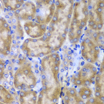 SPARC Rabbit polyclonal antibody