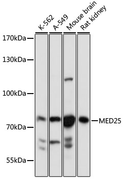 MED25 Rabbit polyclonal antibody