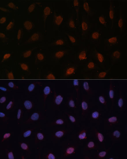 MED25 Rabbit polyclonal antibody