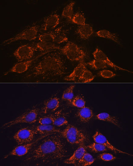 HPS4 Rabbit polyclonal antibody