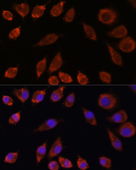 HPS4 Rabbit polyclonal antibody