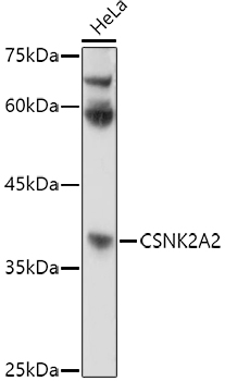 CSNK2A2 Rabbit polyclonal antibody