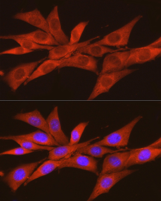 CSNK2A2 Rabbit polyclonal antibody