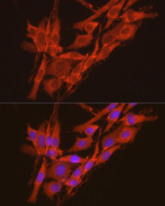 CSNK2A2 Rabbit polyclonal antibody
