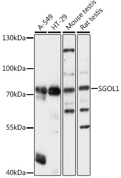 SGOL1 Rabbit polyclonal antibody