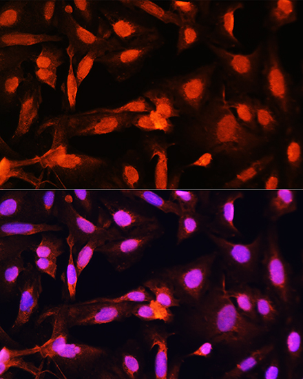 SGOL1 Rabbit polyclonal antibody