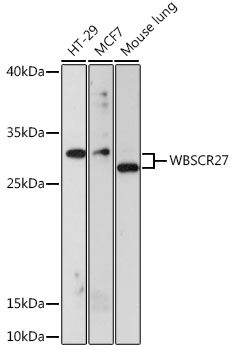 WBSCR27 Rabbit polyclonal antibody