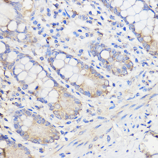 WBSCR27 Rabbit polyclonal antibody