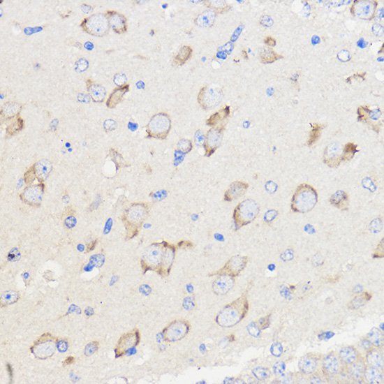 WBSCR27 Rabbit polyclonal antibody