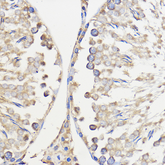 WBSCR27 Rabbit polyclonal antibody