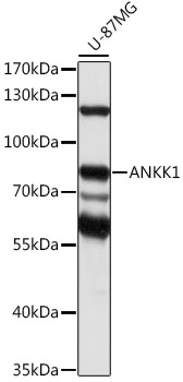 Western blot analysis of lysates from U-87MG cells, using ANKK1 Rabbit pAb (A16178) at 1:1000 dilution.<br/>Secondary antibody: HRP Goat Anti-Rabbit IgG (H+L) (AS014) at 1:10000 dilution.<br/>Lysates/proteins: 25μg per lane.<br/>Blocking buffer: 3% nonfat dry milk in TBST.<br/>Detection: ECL Basic Kit (RM00020).<br/>Exposure time: 30s.