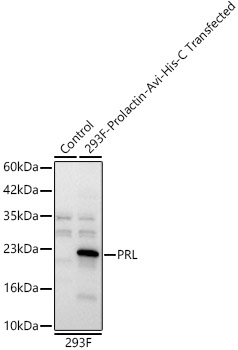 PRL Rabbit polyclonal antibody