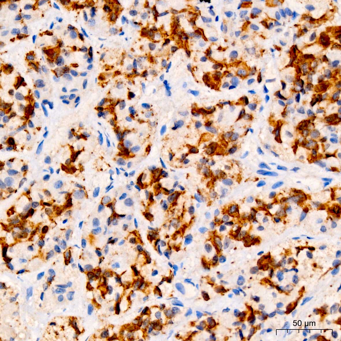 PRL Rabbit polyclonal antibody