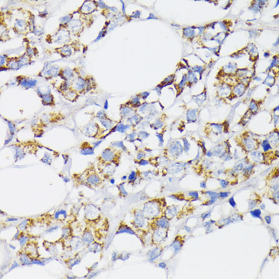 USP33 Rabbit polyclonal antibody
