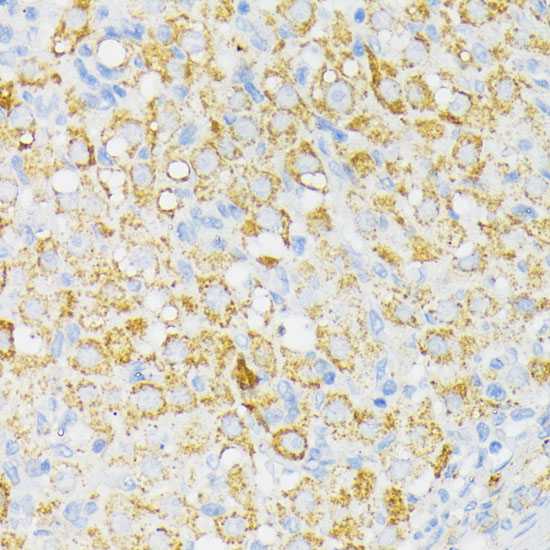 USP33 Rabbit polyclonal antibody