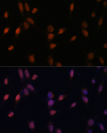 USP33 Rabbit polyclonal antibody