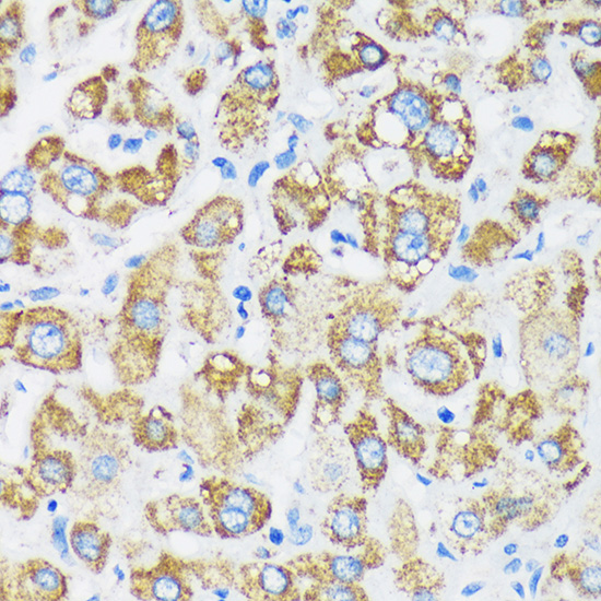 GTPBP8 Rabbit polyclonal antibody