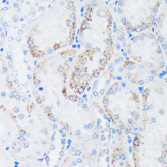 GTPBP8 Rabbit polyclonal antibody
